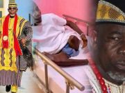 Former Liberian Traditional Council Chairman Chief Zanzan Karwor Speaks from Sickbed After Leg Amputation