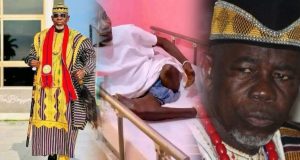 Former Liberian Traditional Council Chairman Chief Zanzan Karwor Speaks from Sickbed After Leg Amputation