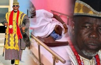 Former Liberian Traditional Council Chairman Chief Zanzan Karwor Speaks from Sickbed After Leg Amputation