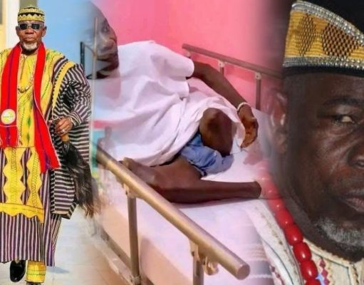 Former Liberian Traditional Council Chairman Chief Zanzan Karwor Speaks from Sickbed After Leg Amputation
