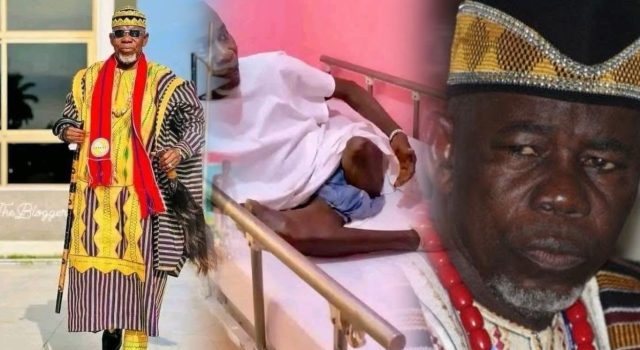 Former Liberian Traditional Council Chairman Chief Zanzan Karwor Speaks from Sickbed After Leg Amputation