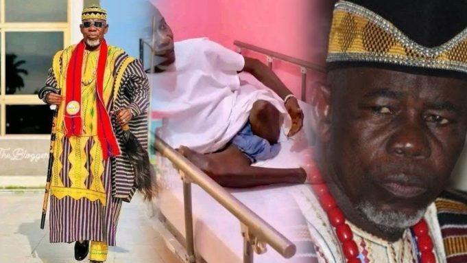 Former Liberian Traditional Council Chairman Chief Zanzan Karwor Speaks from Sickbed After Leg Amputation