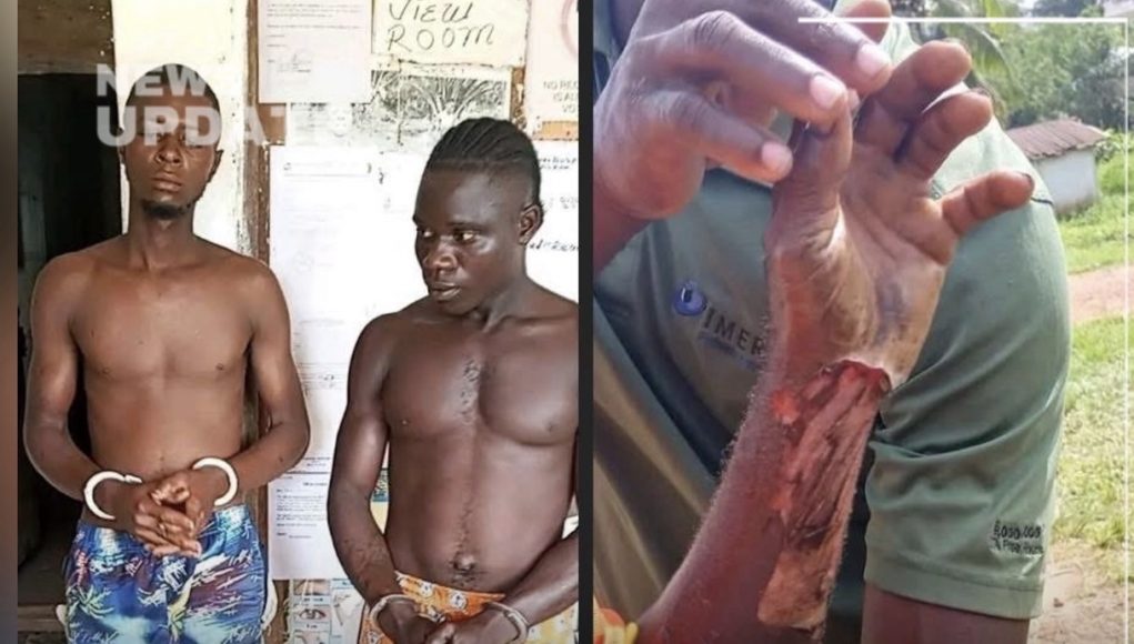 Refusal Turns Violent: Man Beaten and Burned in Grand Kru