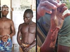 Refusal Turns Violent: Man Beaten and Burned in Grand Kru