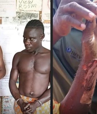 Refusal Turns Violent: Man Beaten and Burned in Grand Kru