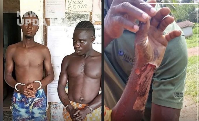 Refusal Turns Violent: Man Beaten and Burned in Grand Kru
